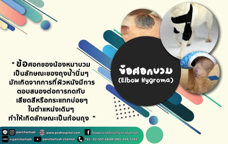 ข้อศอกบวม(Elbow Hygroma )