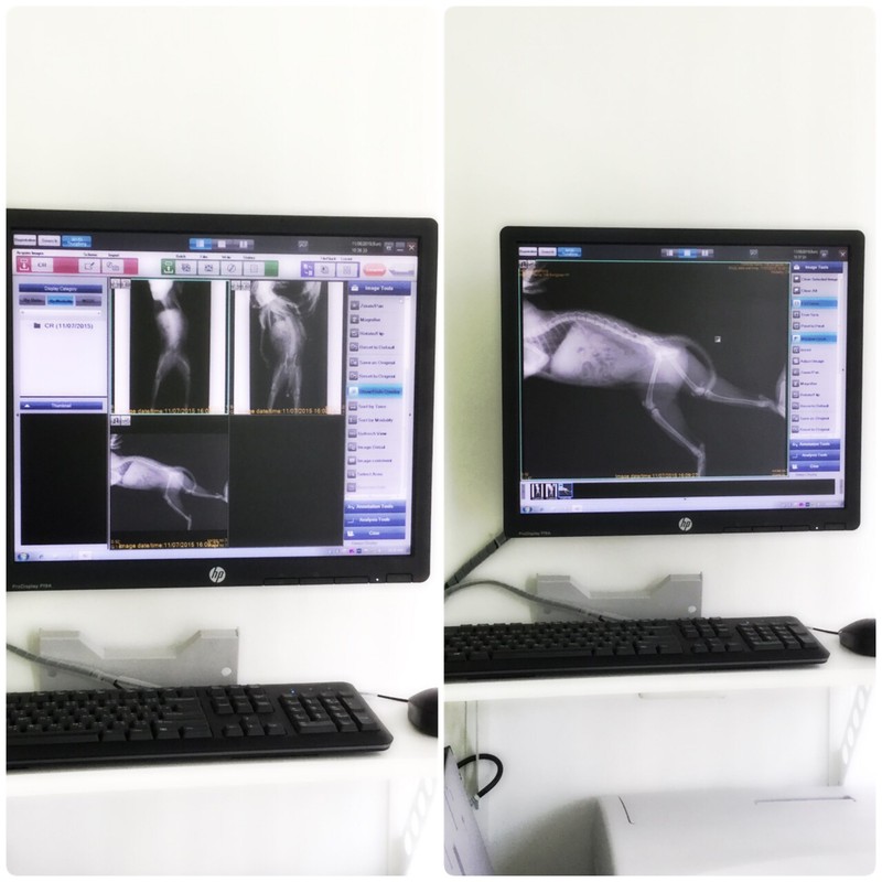 X-ray digital